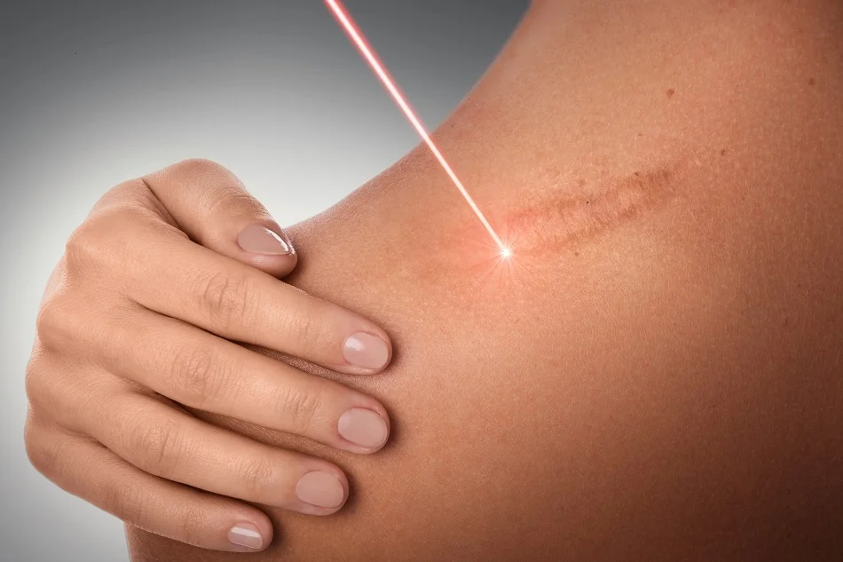 laser ray on shoulder body