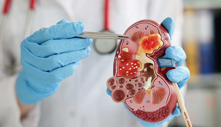 Kidney Structure Show